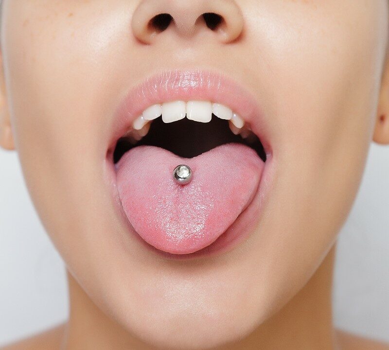 Piercing (perforación cosmética) en la boca