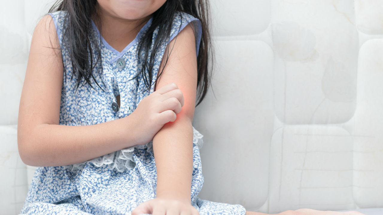 Psoriasis infantil: los chicos y el diagnóstico
