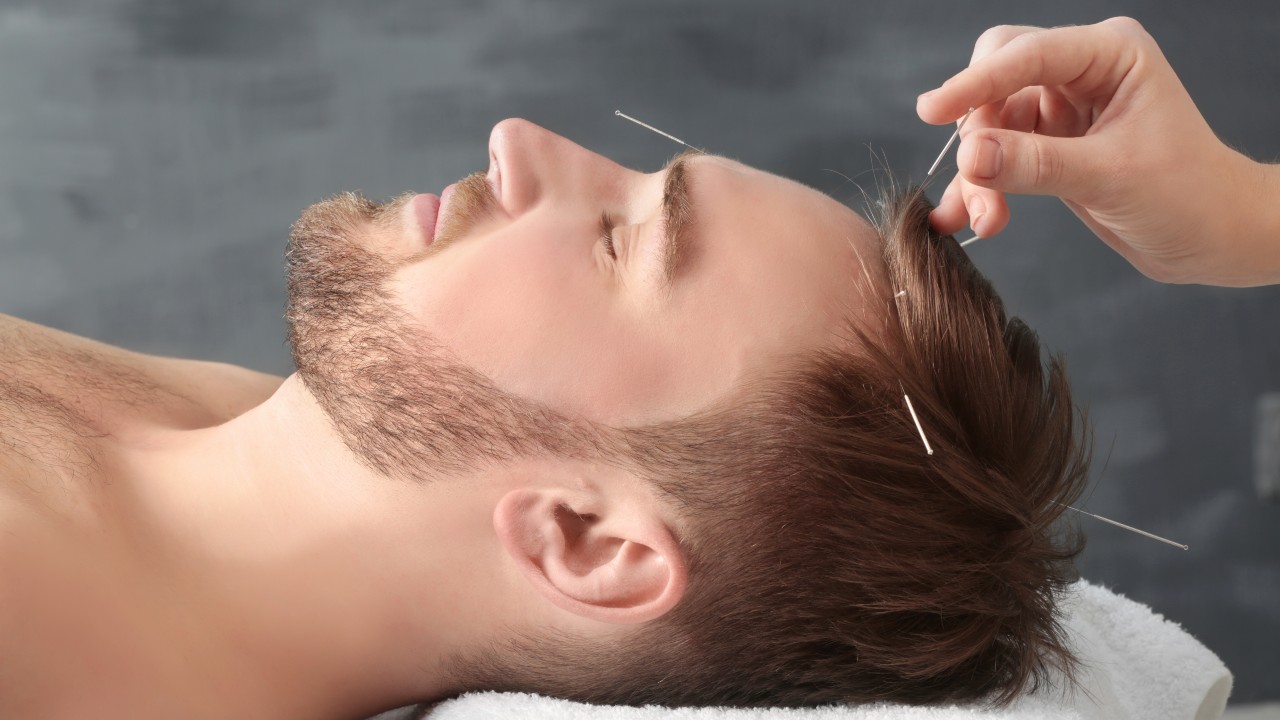 La acupuntura podría mejorar la memoria