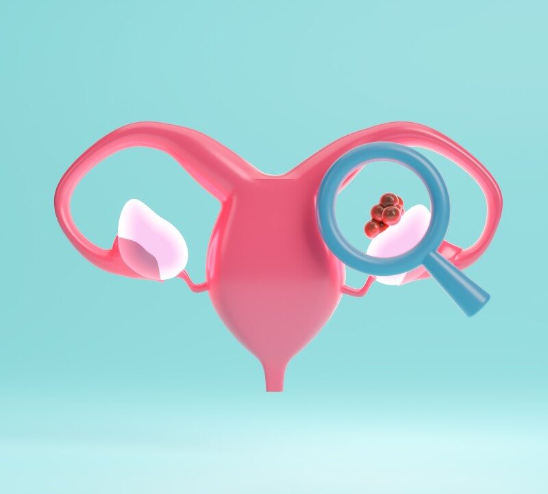 Descubren un tratamiento nuevo para el cáncer del ovario