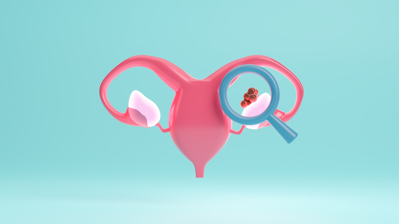 Descubren un tratamiento nuevo para el cáncer del ovario