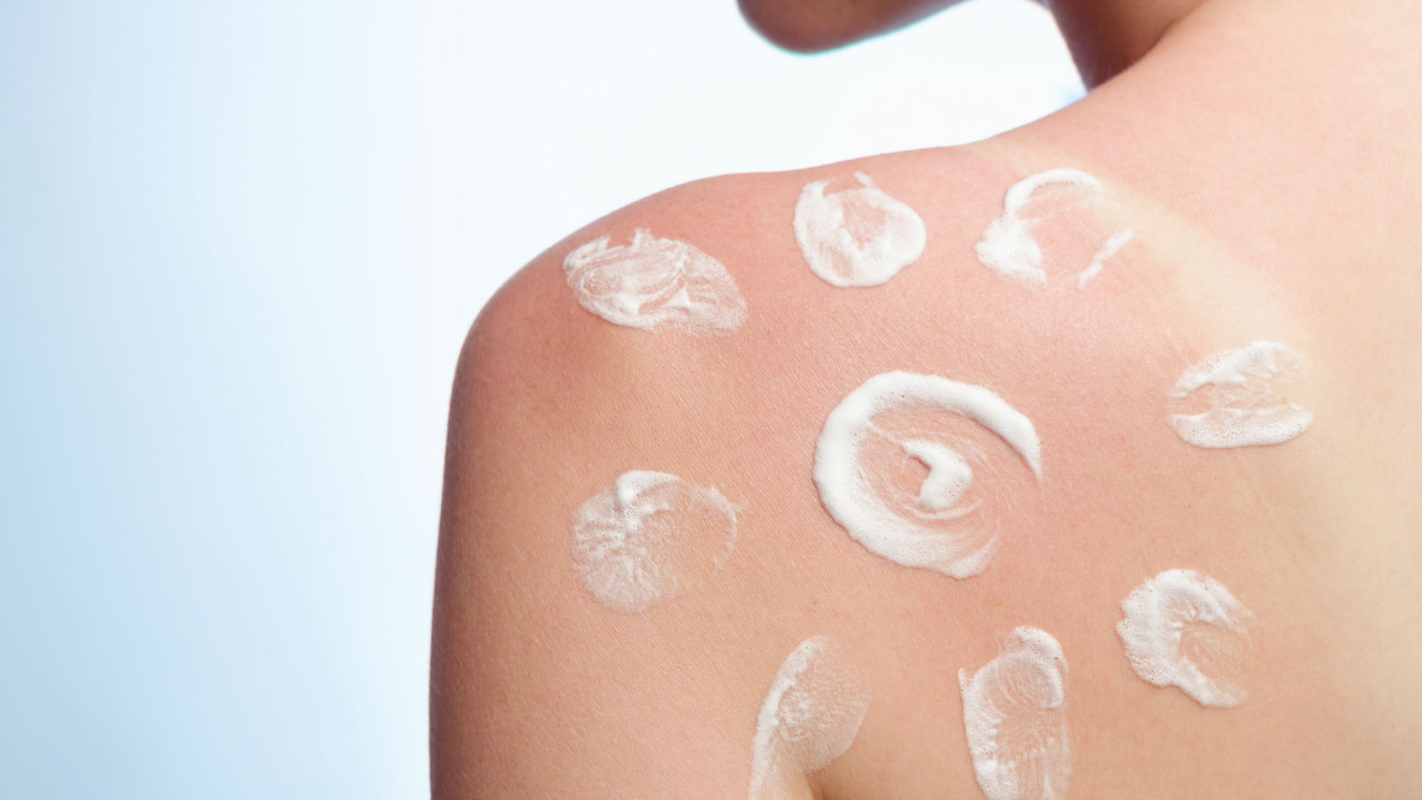 Lo que debes saber sobre el cáncer de la piel