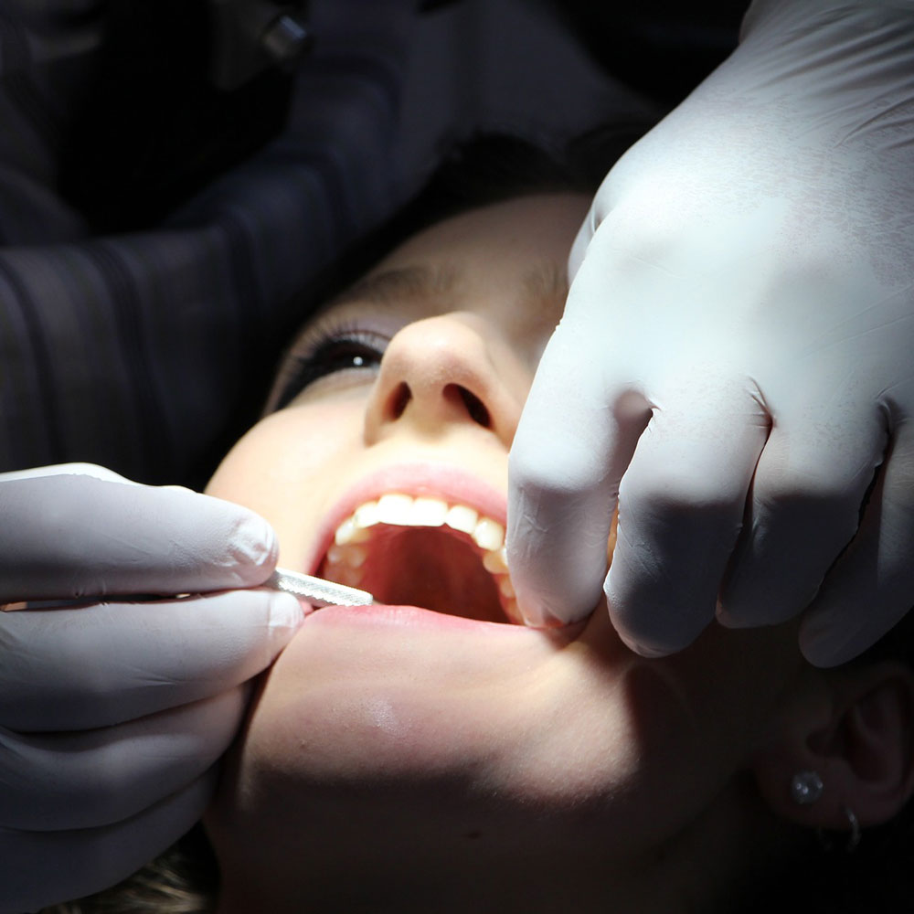 ¿Qué se debe hacer antes y después de una extracción dental?
