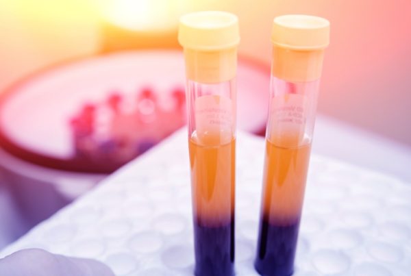 Donar plasma puede salvar vidas