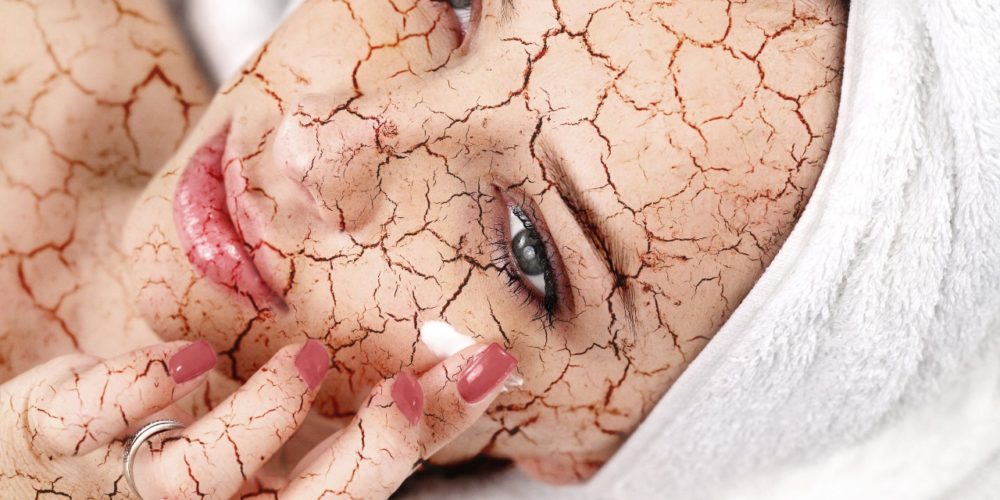 Piel seca: ¿conoces las causas de la resequedad de la piel?