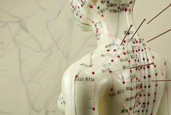Acupuntura: ¿Qué dice la ciencia?