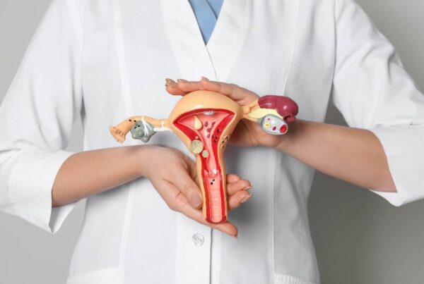 ¿Sabes qué es la endometriosis?