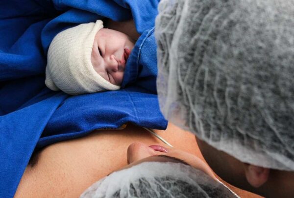 ¿Tiene efectos a largo plazo inducir el parto?