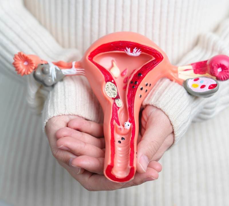 Cáncer de ovario- quinta causa de muerte en mujeres latinas