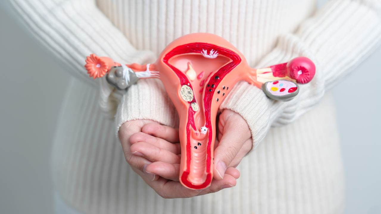 Cáncer de ovario: quinta causa de muerte en mujeres latinas
