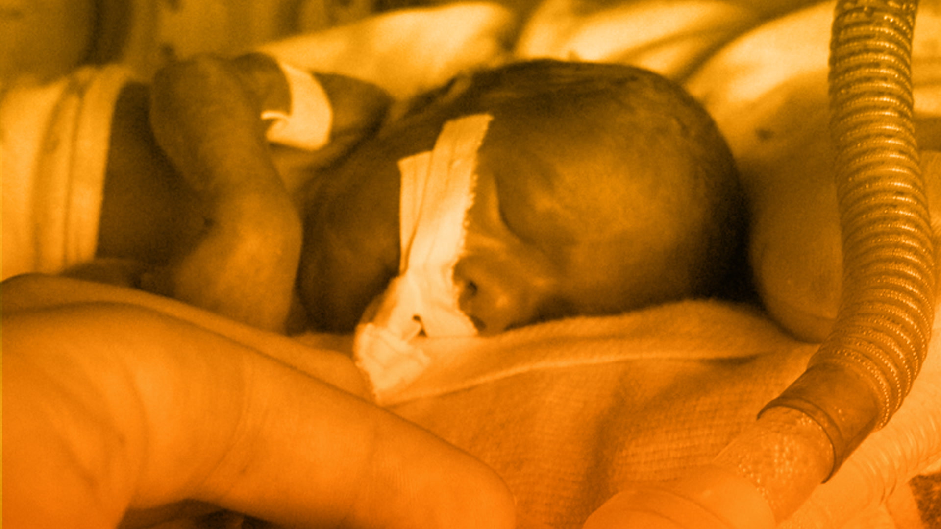 Babyleo es un sistema que simula el útero de la madre para bebes prematuros