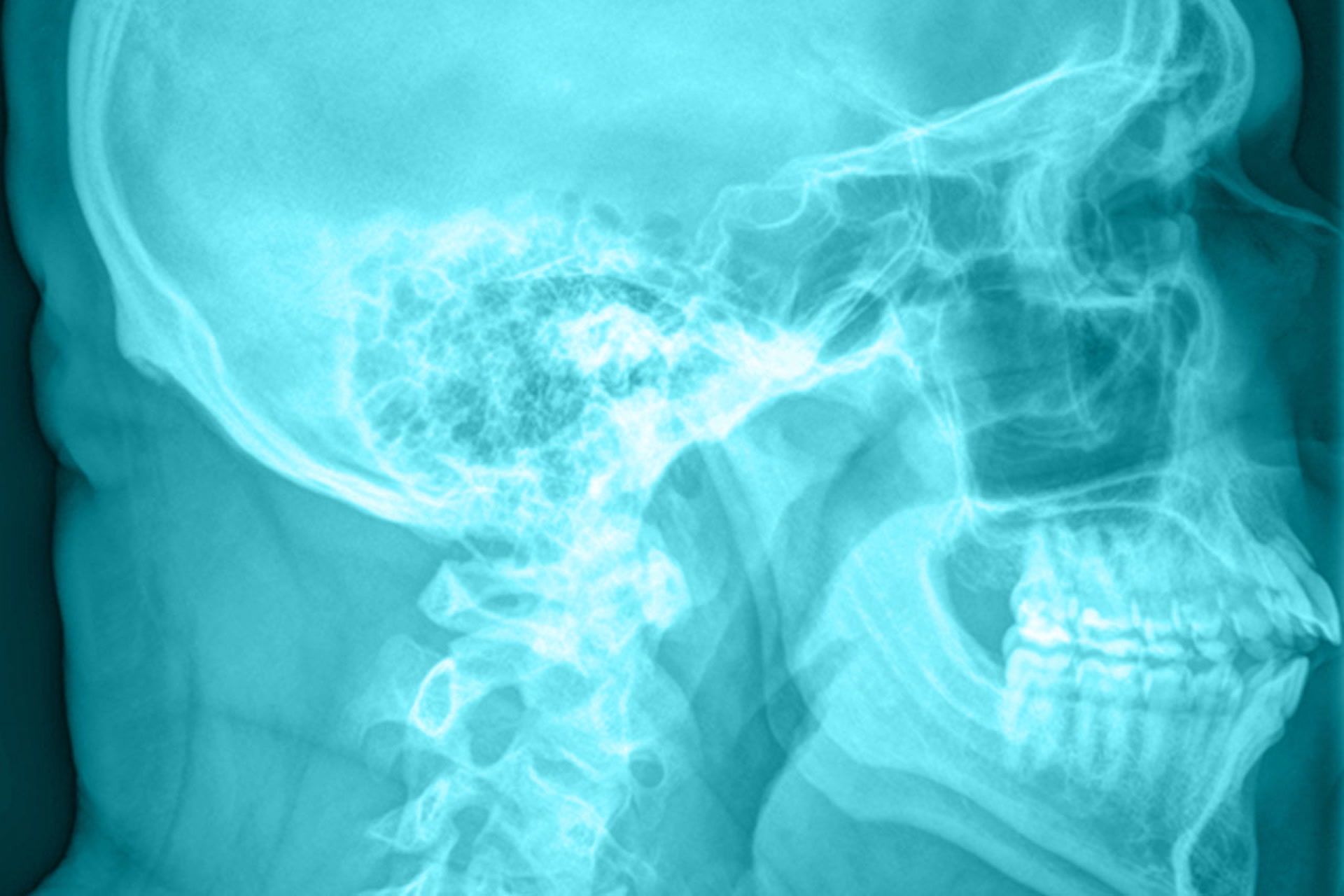 ¿Qué es la radiología?