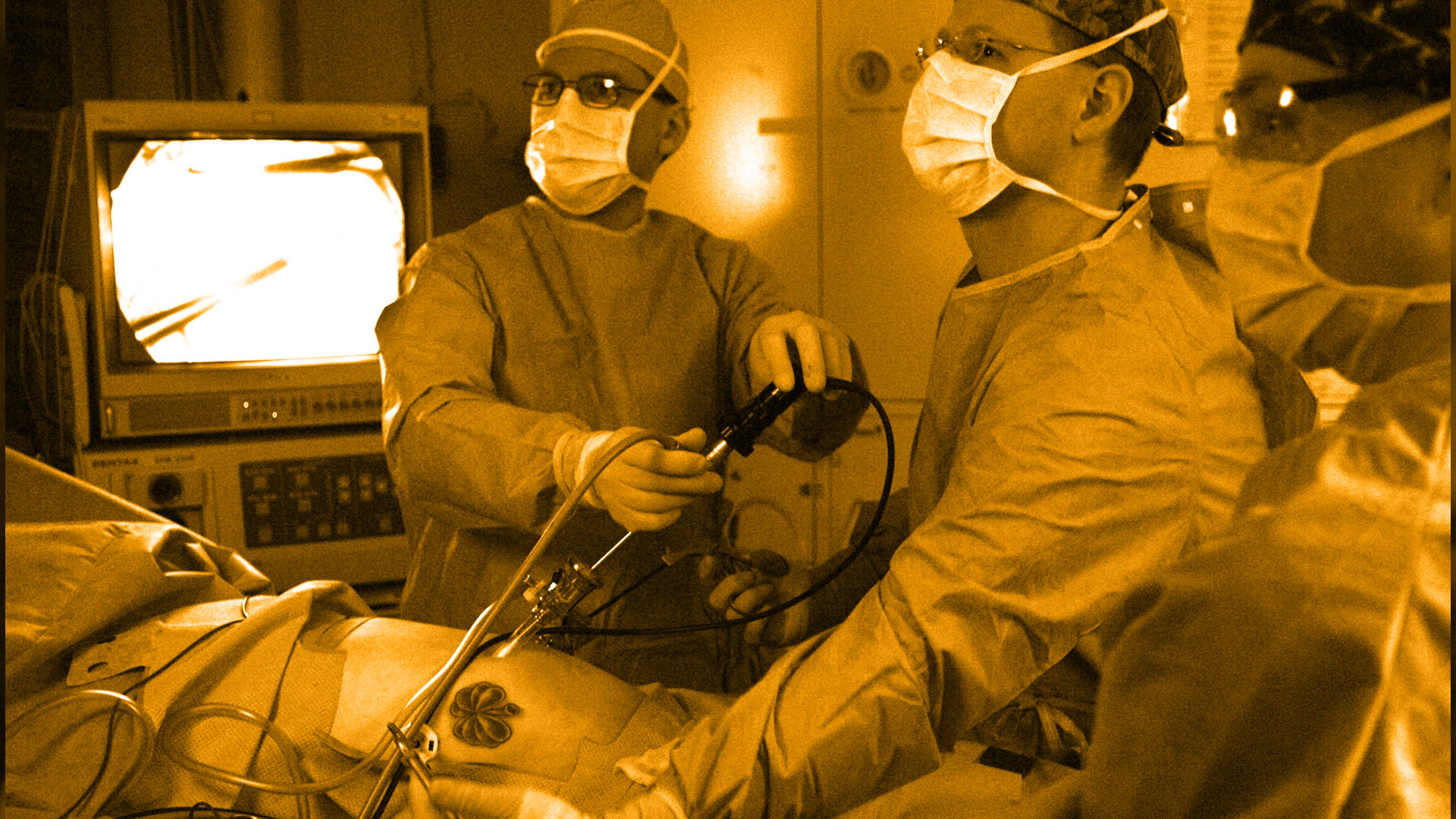 ¿Cuándo debe practicarse una laparoscopia?