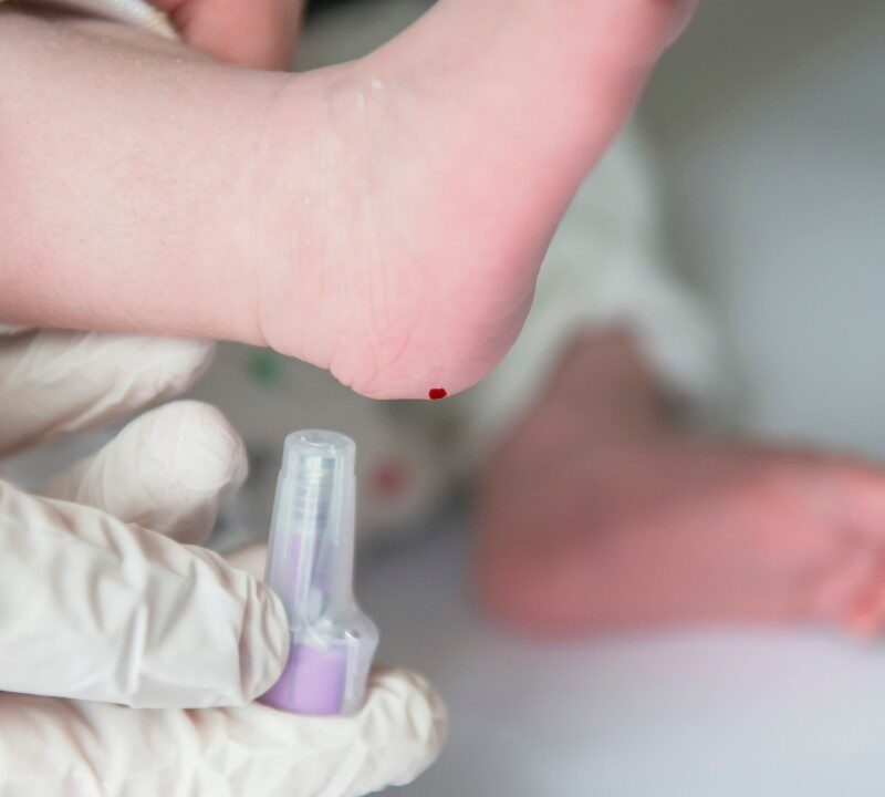 ¿En qué consiste la prueba del talón o cribado neonatal?