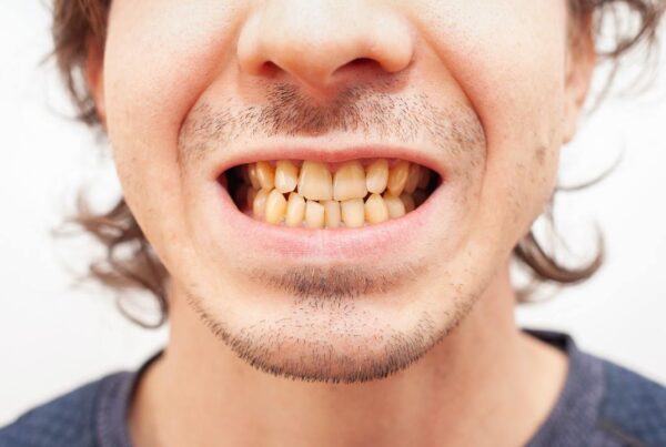 ¿Existe una conexión entre los dientes amarillos y los antibióticos?