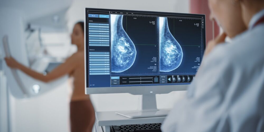 Nueva forma de luchar contra el cáncer de mama de alto riesgo