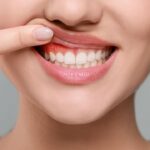 Encías enfermas, corazón en riesgo: ¡Descubre por qué!