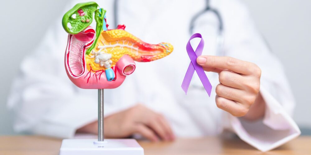 Representación del tratamiento y diagnóstico de tumores neuroendocrinos.