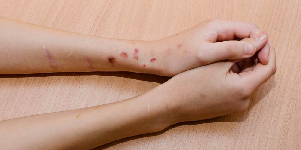 Persona joven mostrando señales de autolesión en las muñecas, con expresión de tristeza y aislamiento, buscando apoyo