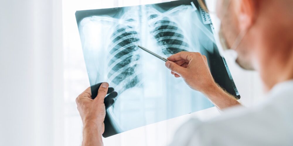 La tuberculosis en el siglo 21, avances y desafíos.