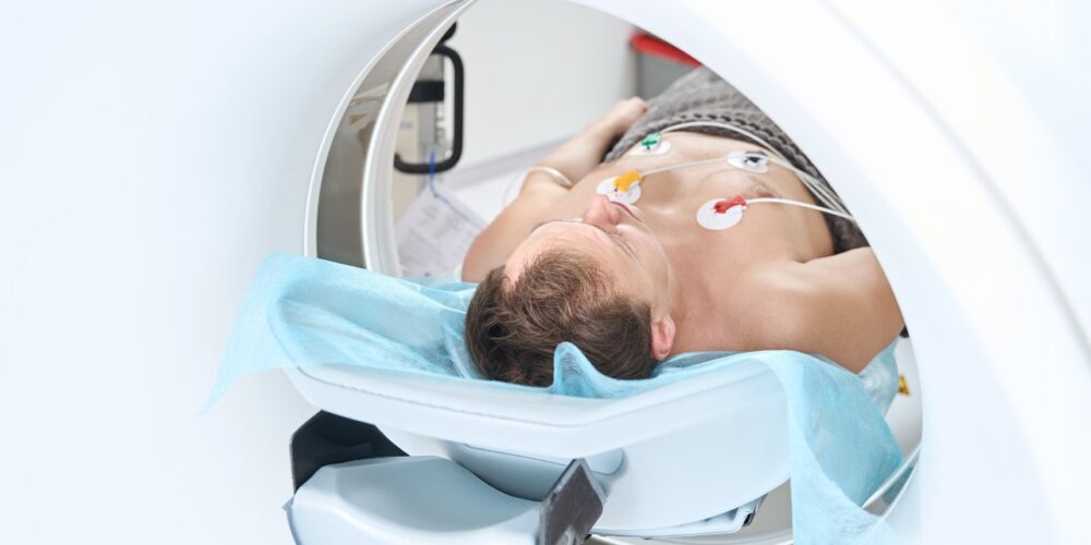 Procedimiento de angiografía mostrando el flujo sanguíneo en arterias