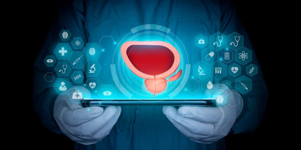 avances médicos en el tratamiento del cáncer de próstata