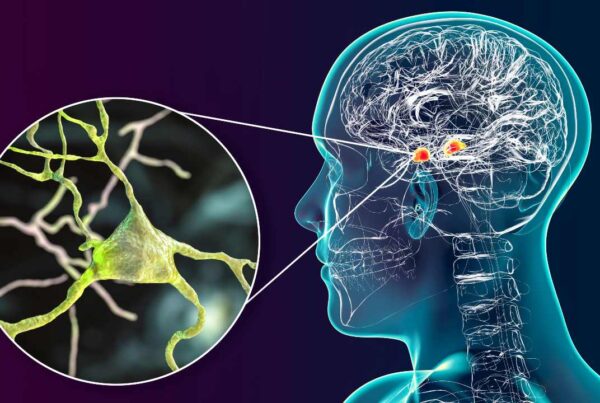 Cerebro humano procesando decisiones a través de estímulos conectados