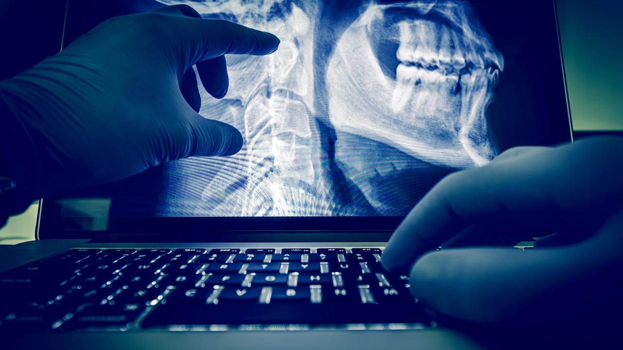 Cáncer en el interior del diente: señales, diagnóstico y opciones