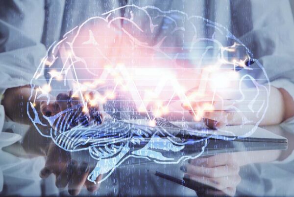 Representación cerebral estable del brazo tras amputación