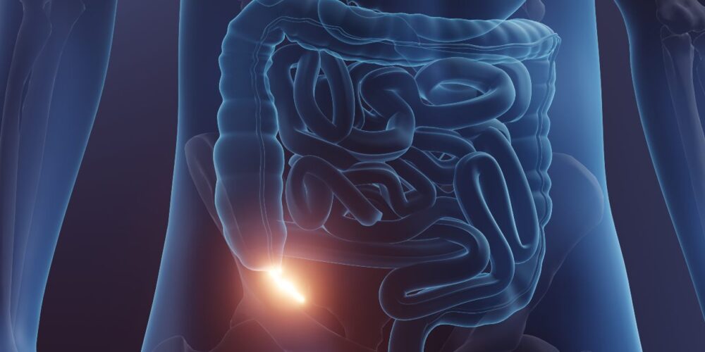 ilustración del apéndice y su función intestinal