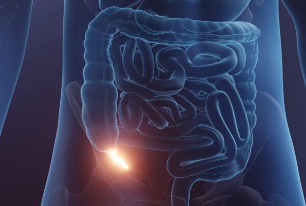 ilustración del apéndice y su función intestinal