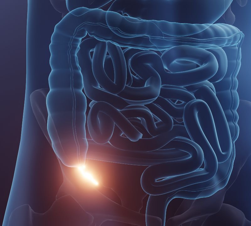 ilustración del apéndice y su función intestinal