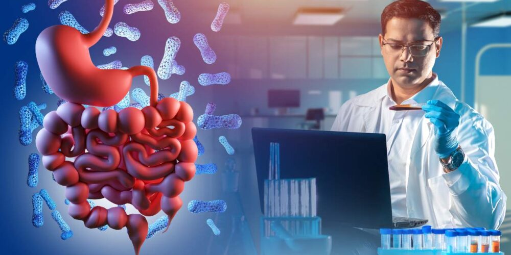 Cómo la microbiota intestinal podría ser clave en la aterosclerosis