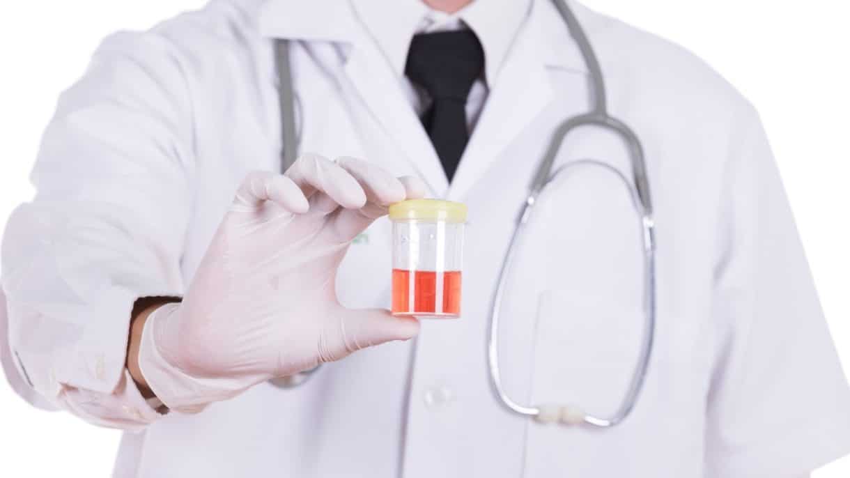 Gota de sangre visible en orina, posible hematuria