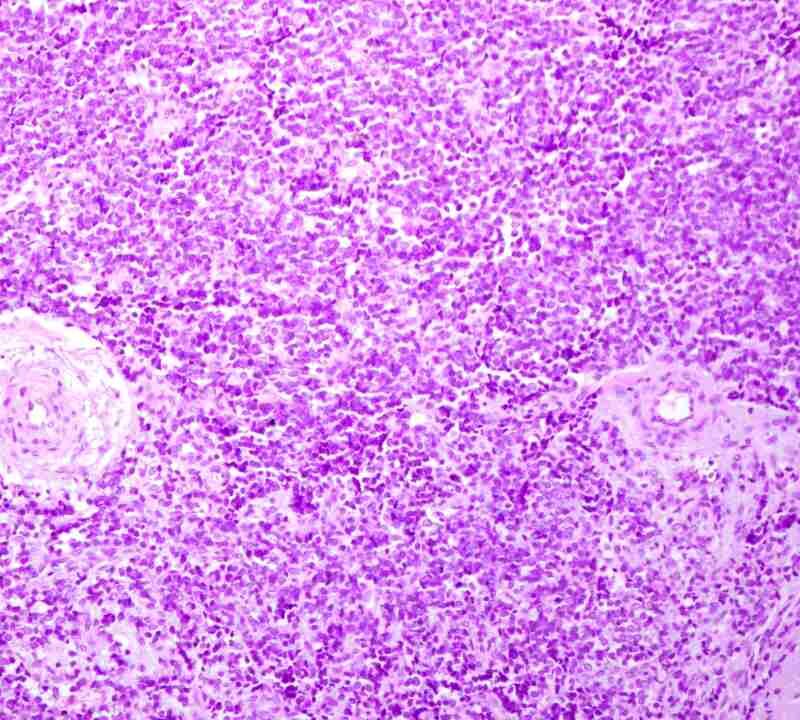 Alt text imagen: Células mesenquimales embrionarias humanas estudiadas para el Sarcoma de Ewing