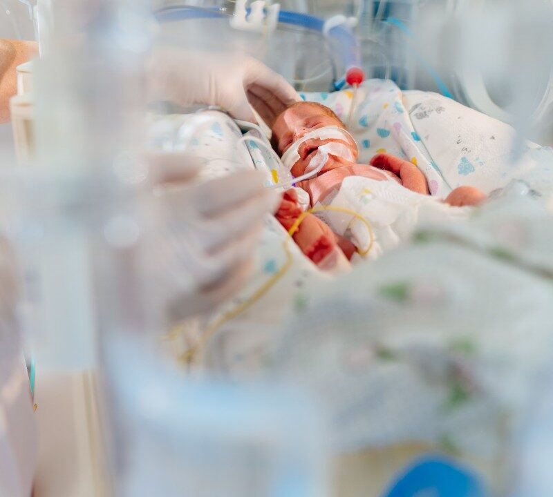 Bebé prematuro descansando dentro de una incubadora neonatal rodeado de monitores médicos.