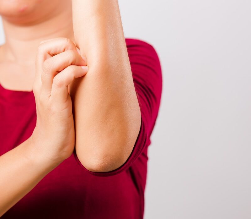 Persona rascándose el brazo por picor en la piel sin lesiones visibles