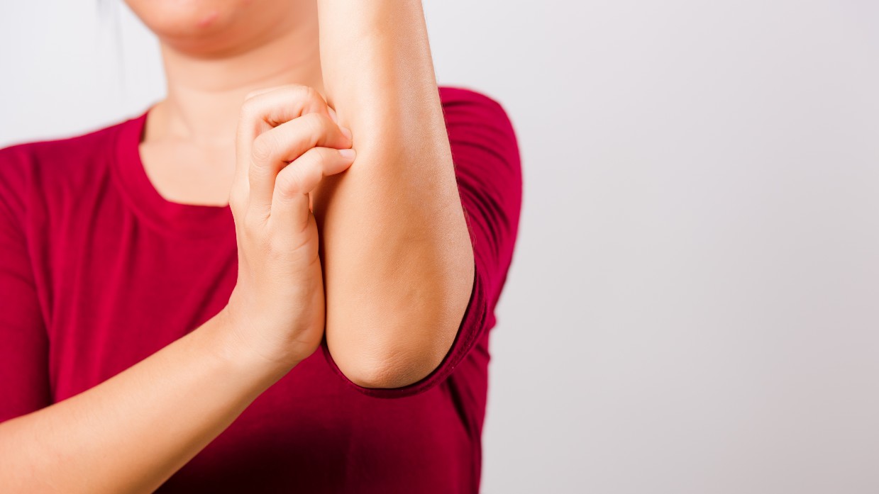 Picor en la piel: cuándo puede ser señal de otra enfermedad