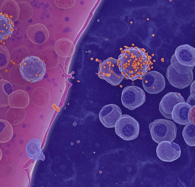 Ilustración médica de linfocitos B infectados por el virus de Epstein-Barr relacionados con lupus