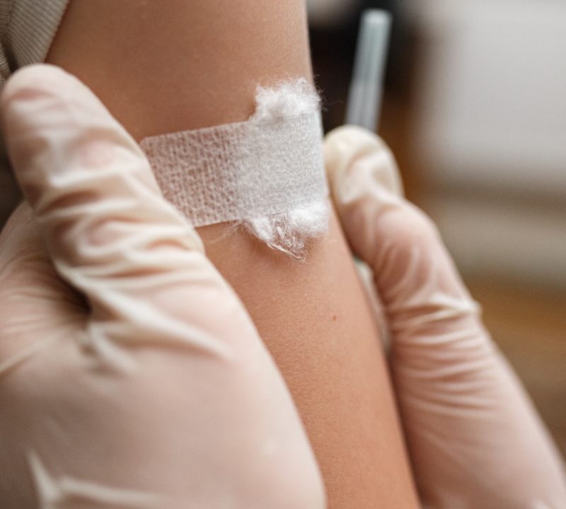 Primer plano de un pequeño parche circular sobre el hombro de un niño tras una inmunización, en un entorno clínico suave y luminoso que transmite seguridad y cuidado infantil.