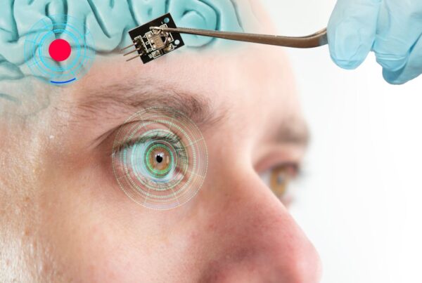 Implante cerebral que estimula neuronas para crear visión