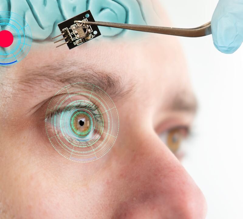 Implante cerebral que estimula neuronas para crear visión