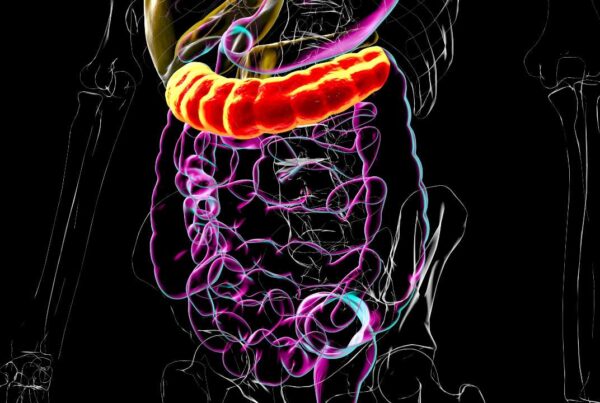 Ilustración del intestino grueso resaltando el colon