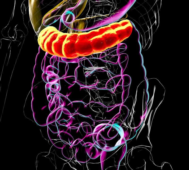 Ilustración del intestino grueso resaltando el colon