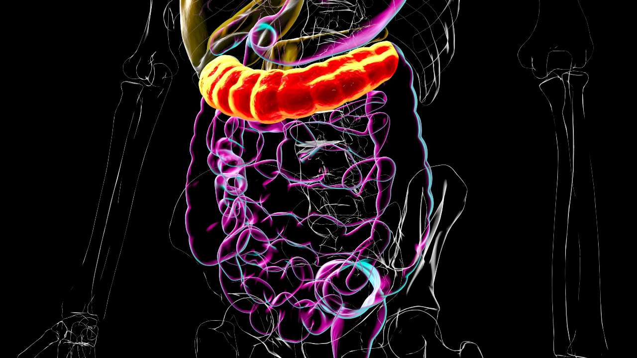 ¿El entorno influye en el cáncer colorrectal joven?