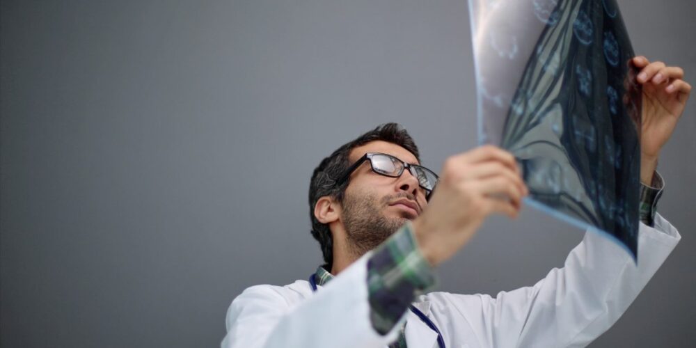 Resonancia magnética cerebral que ayuda a detectar enfermedades neurológicas confundidas con Parkinson