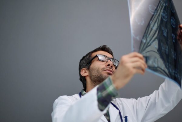 Resonancia magnética cerebral que ayuda a detectar enfermedades neurológicas confundidas con Parkinson