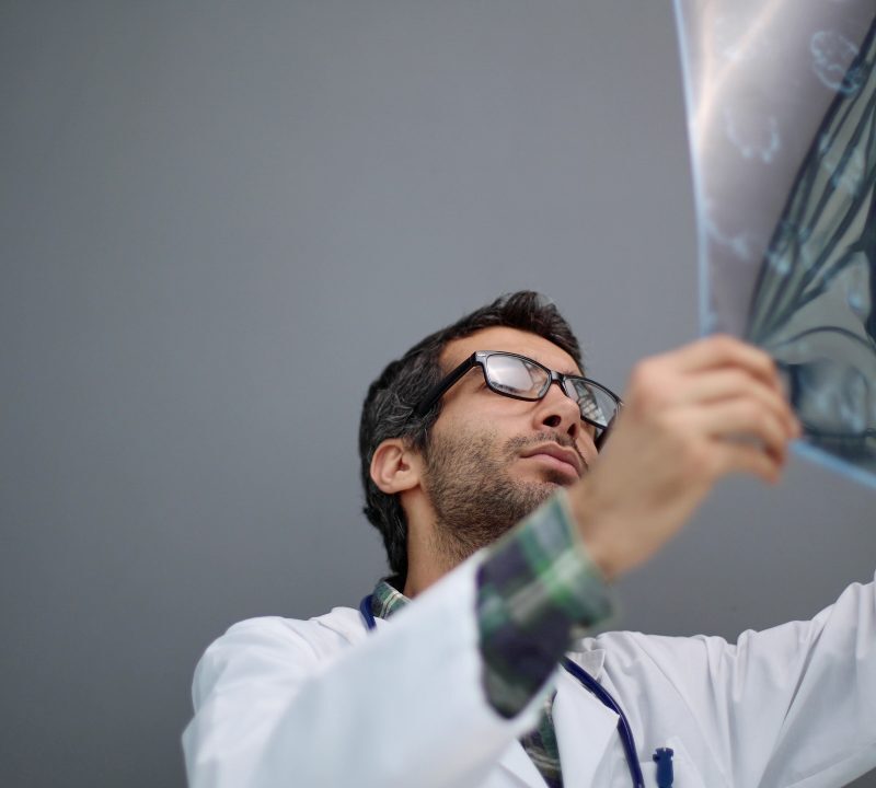 Resonancia magnética cerebral que ayuda a detectar enfermedades neurológicas confundidas con Parkinson