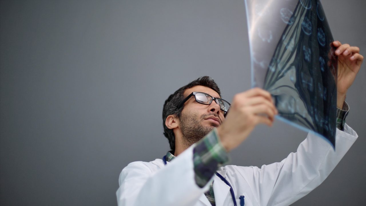 ¿Es Parkinson o algo más? La resonancia puede detectarlo