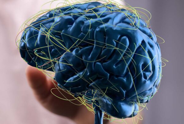 Desarrollo del cerebro en la infancia en síndrome de Down y redes neuronales